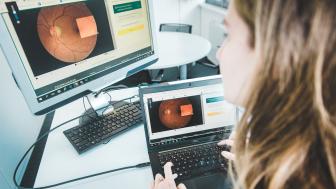 AI van Vito en VUB spoort oogziekte op. Dame analyseert een beeld
